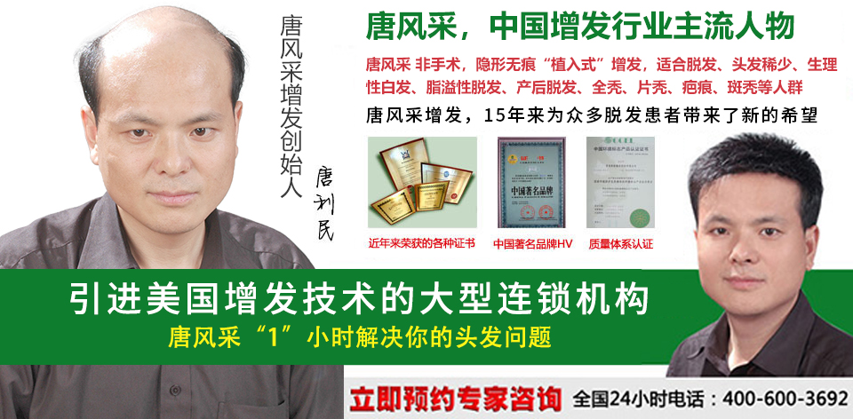 織發(fā)補(bǔ)發(fā)大型連鎖機(jī)構(gòu) 唐風(fēng)采增發(fā)