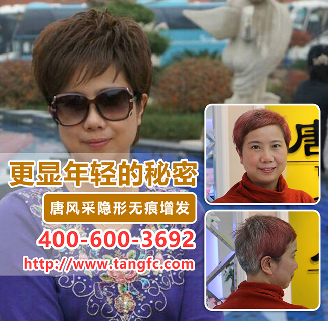 脫發(fā)掉發(fā) 燙發(fā)染發(fā)者福音:頭皮注氧減緩掉發(fā)