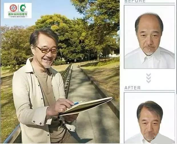來自NASA的黑科技生發(fā)頭盔，禿頂有救了？