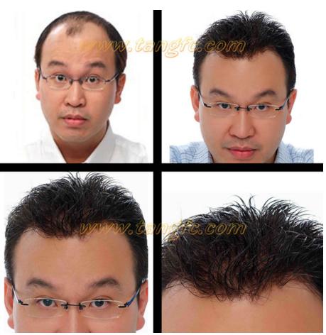 來自NASA的黑科技生發(fā)頭盔，禿頂有救了？