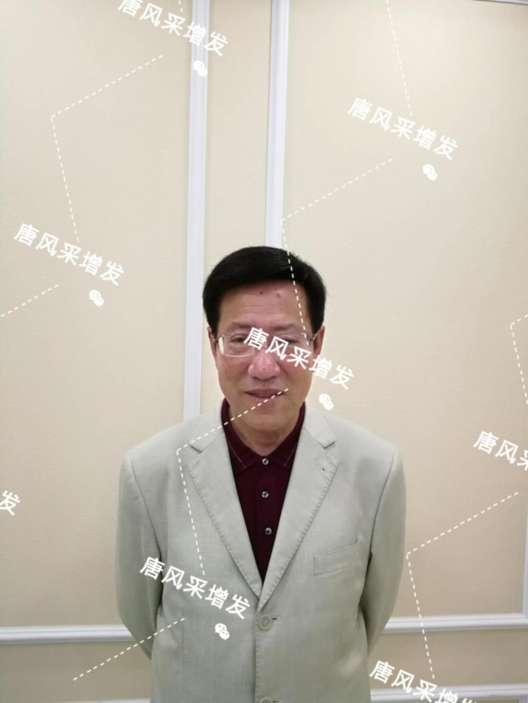脫發(fā)禿頂成中年男人標(biāo)配？唐風(fēng)采增發(fā)讓您風(fēng)采始終如一