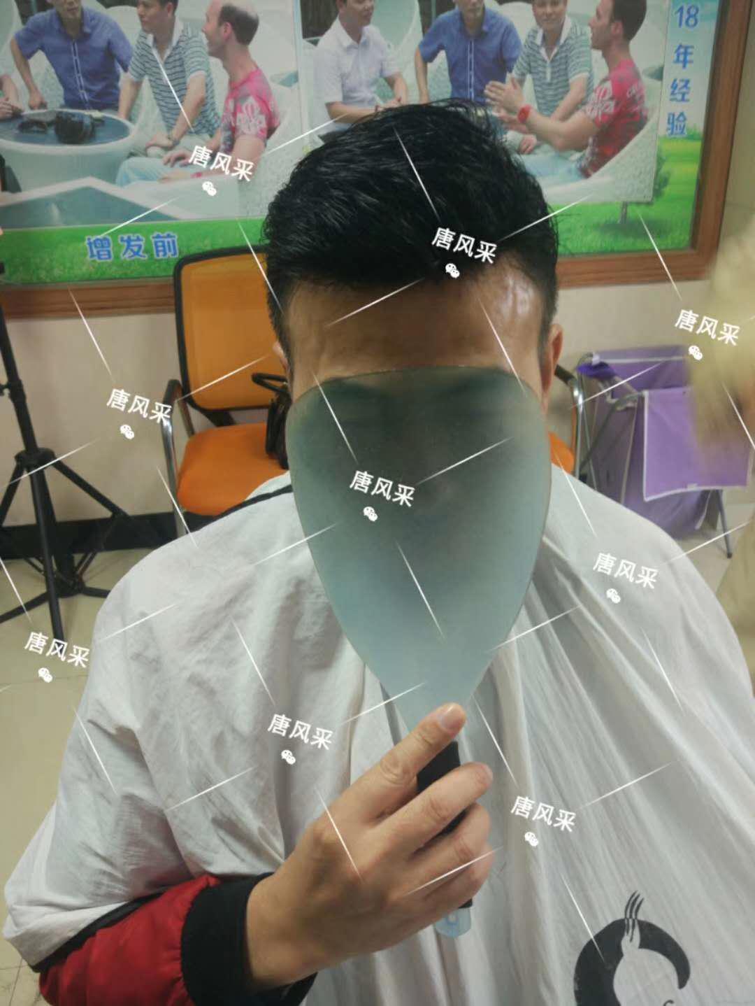  一轉眼年輕十歲，你差的就是這點點頭發(fā)！