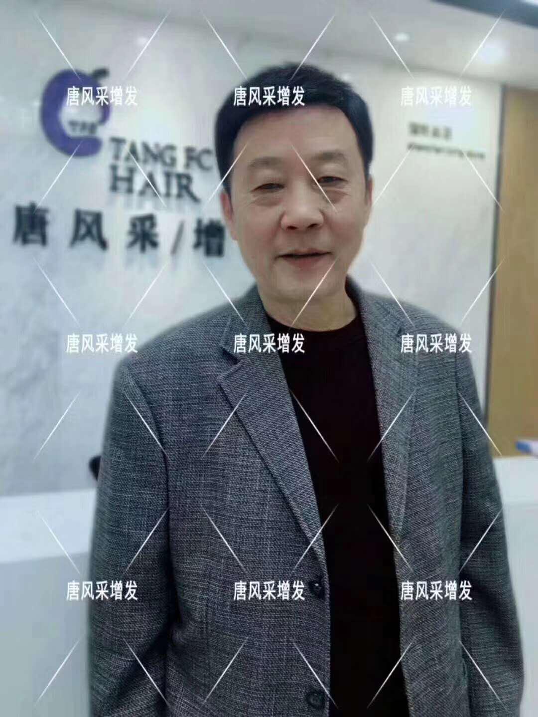 常按這個(gè)穴位好處多多 有助睡眠還能減少白頭發(fā)！