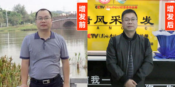 稀發(fā)不哭！終于知道頭發(fā)稀疏可以這樣做。