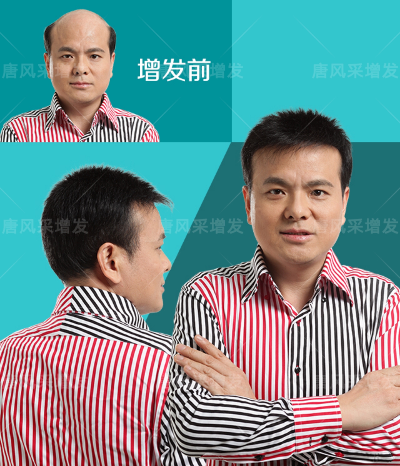 稀發(fā)不哭！終于知道頭發(fā)稀疏可以這樣做！