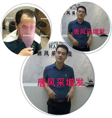 光禿禿的院子光禿禿的頭，與其羨慕不如改變！