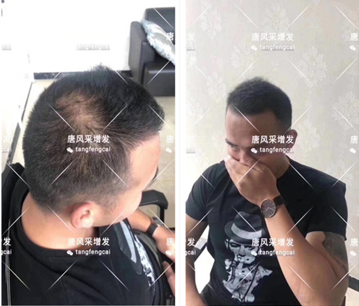 特朗普大背頭造型 唐風(fēng)采客戶增發(fā)對比圖