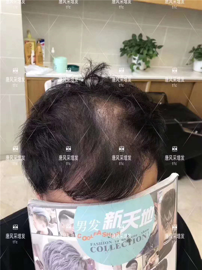 謝頂男人 在唐風(fēng)采增發(fā)后