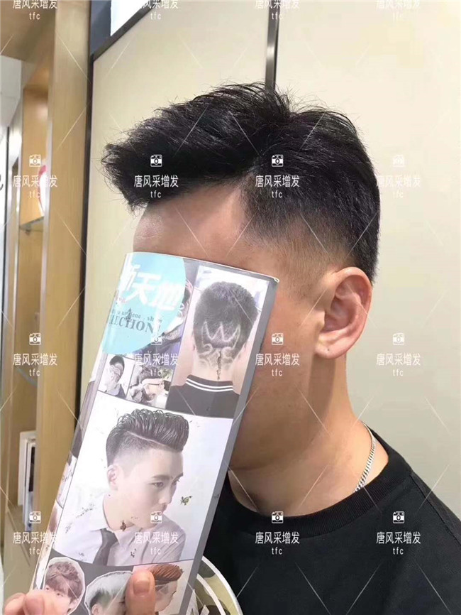 謝頂男人 在唐風(fēng)采增發(fā)后