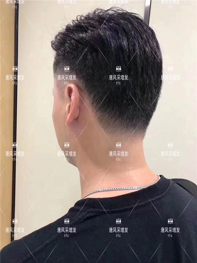 謝頂男人 在唐風(fēng)采增發(fā)后