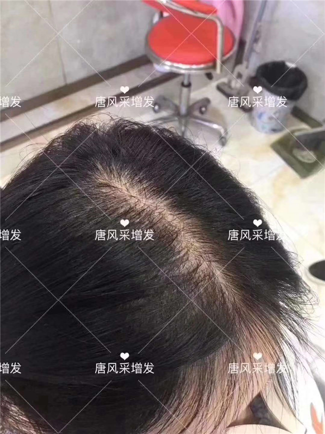劉海假發(fā)