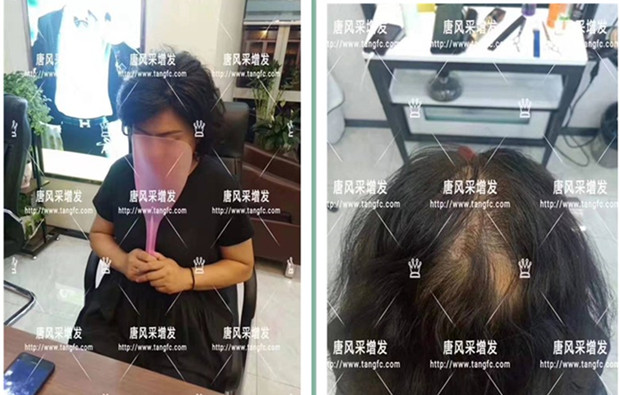 時尚假發(fā) 官方二維碼 客戶案例