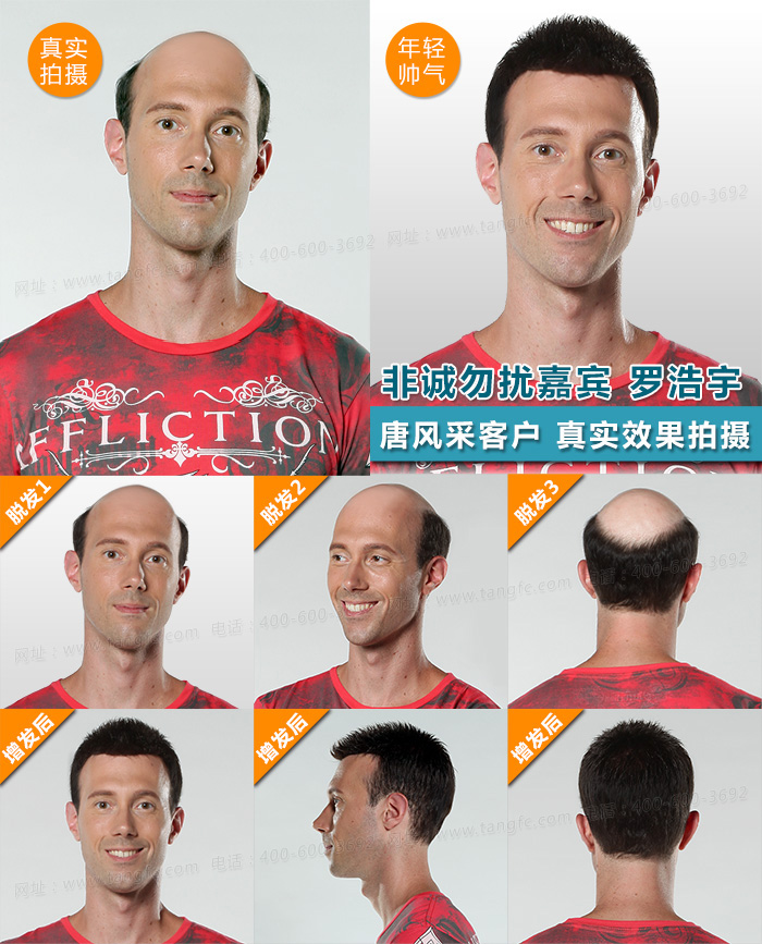 手鉤假發(fā) 唐風(fēng)采客戶案例