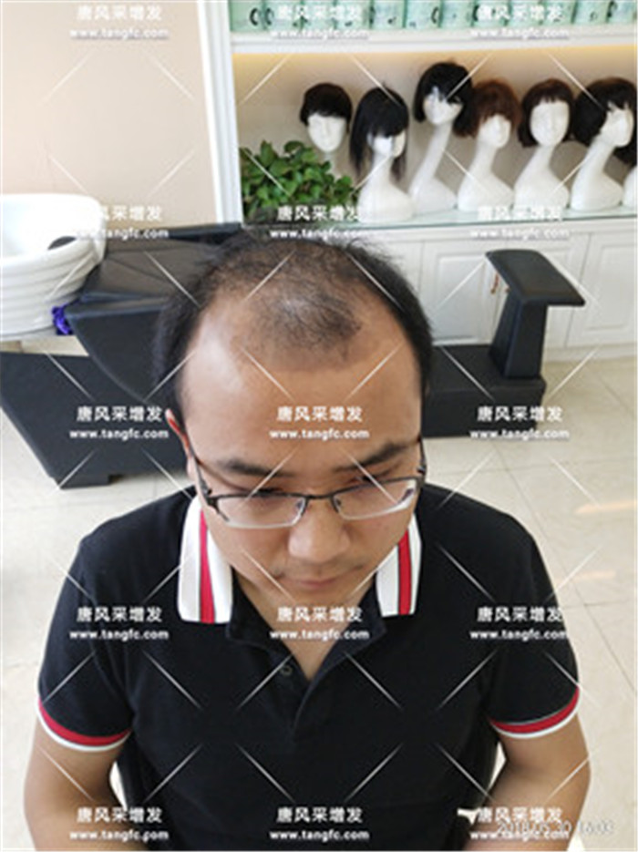 男明星假發(fā) 唐風(fēng)采客戶案例