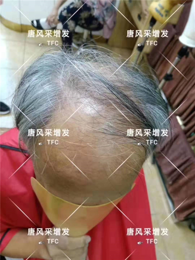 中老年人假發(fā)專賣店 唐風(fēng)采客戶案例