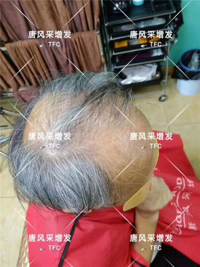 中老年人假發(fā)專賣店 唐風(fēng)采客戶案例
