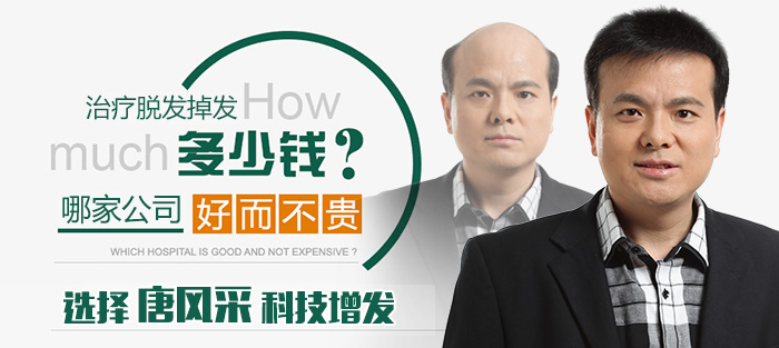 真發(fā)假發(fā)專(zhuān)賣(mài)店 唐風(fēng)采假發(fā)價(jià)格
