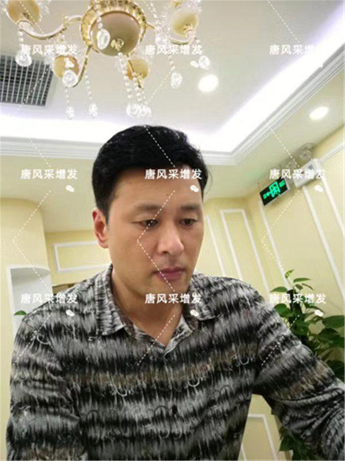 仿真假發(fā)專賣店 唐風(fēng)采客戶案例增發(fā)后