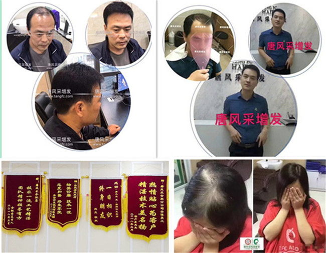 仿真頭皮假發(fā) 唐風(fēng)采客戶(hù)案例篇