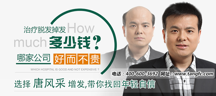 無(wú)痕補(bǔ)發(fā)哪家好 唐風(fēng)采補(bǔ)發(fā)價(jià)格
