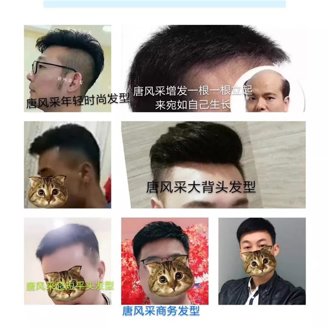 唐風(fēng)采福州店 真實客戶案例分享篇照