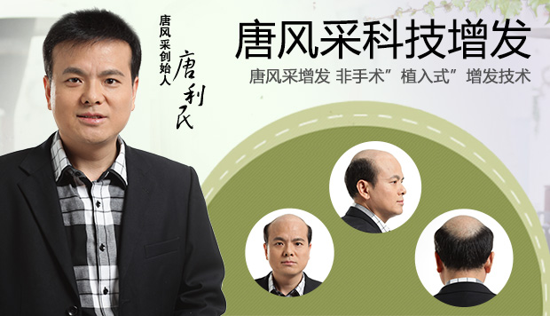 真發(fā)假頭套如何護(hù)理 唐風(fēng)采增發(fā)