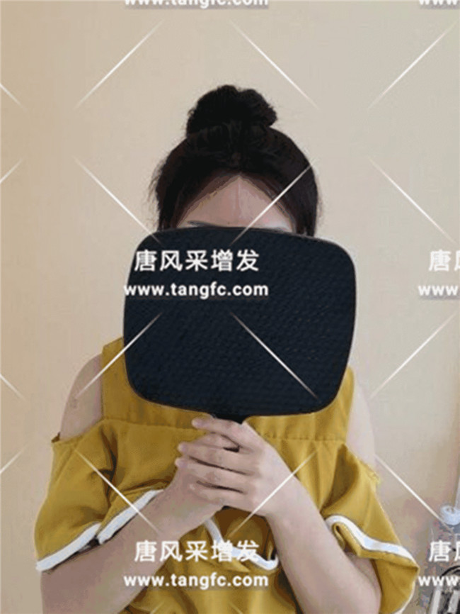 丸子頭發(fā)際線 丸子頭導(dǎo)致發(fā)際線越來越高