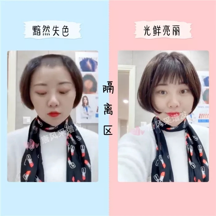 真發(fā)劉海片 戴上真發(fā)劉海片前后對(duì)比圖