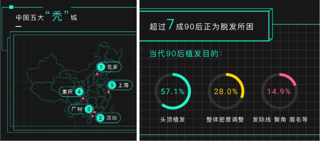 脫發(fā) 北上廣深脫發(fā)嚴(yán)重