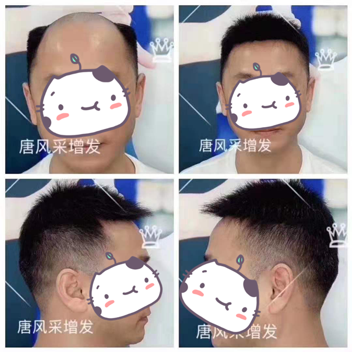 網(wǎng)上哪里買(mǎi)假發(fā)好 實(shí)體店可以觀察很多做工細(xì)節(jié)