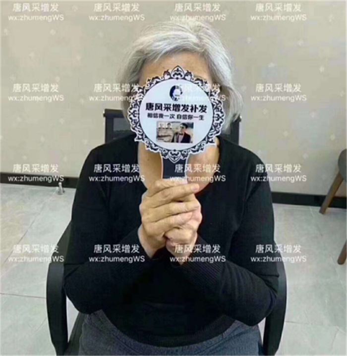 中老年人假發(fā)怎么買 張阿姨增發(fā)前