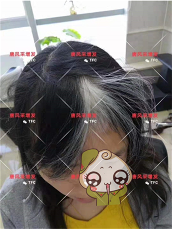 女生假發(fā)專賣店 唐風(fēng)采客戶增發(fā)前