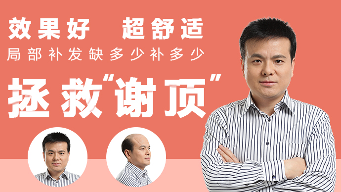 兒童假發(fā)頭套 可以選擇購買兒童假發(fā)頭套
