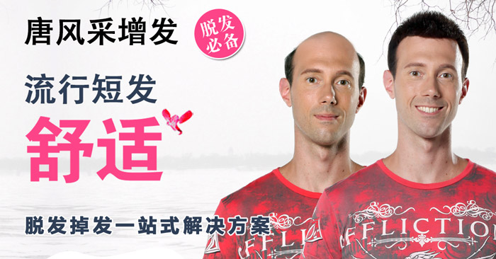 男士配置一頂短假發(fā)需要多少錢 謝頂恢復(fù)形象的辦法是戴假發(fā)
