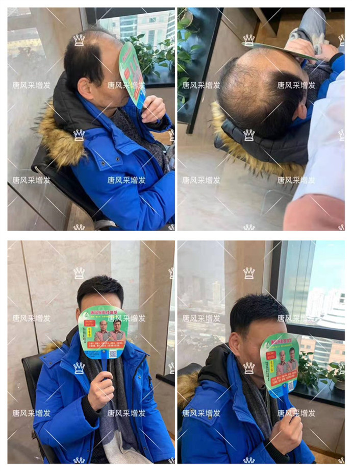 老人的假發(fā)套 唐風(fēng)采客戶