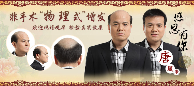假發(fā)要多少錢 唐風(fēng)采定制假發(fā)