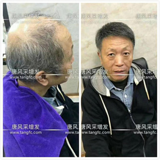 中老年男士真發(fā)假發(fā) 唐風(fēng)采客戶自然真實(shí)的佩戴效果