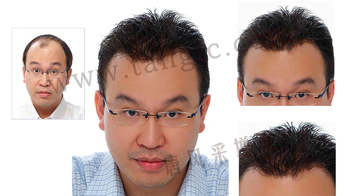 如果你hold不住謝頂，可以來試試真人頭發(fā)的假發(fā)