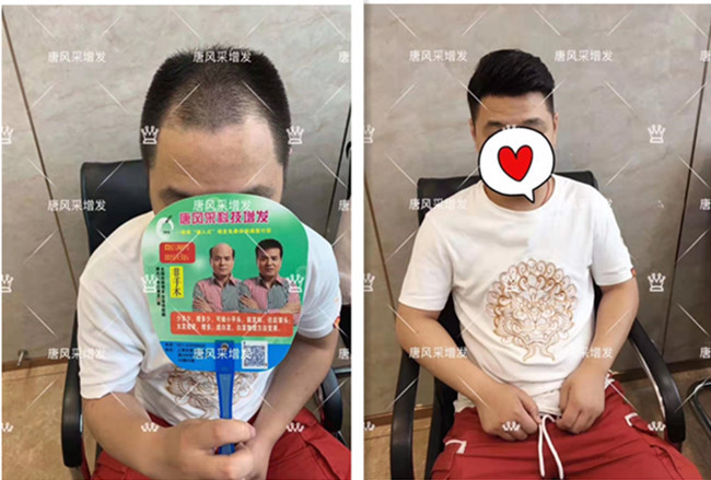 毛寸假發(fā) \