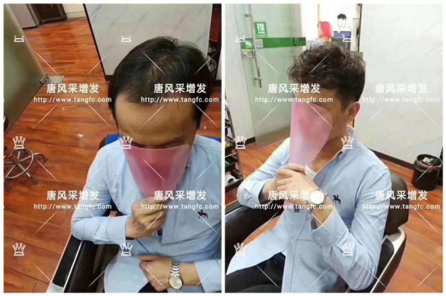 假發(fā)修剪 \