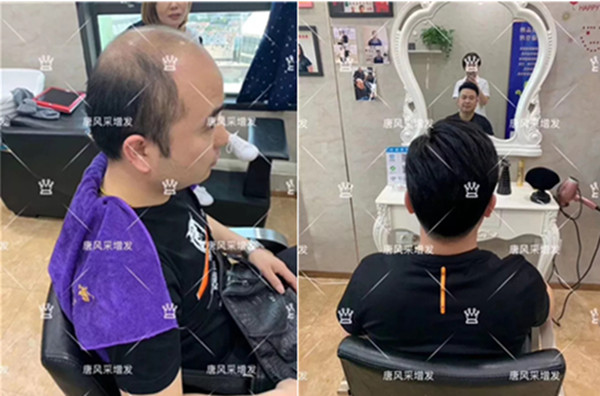 假發(fā)怎么戴才夠自然 \