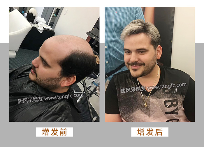 唐風(fēng)采增發(fā) \