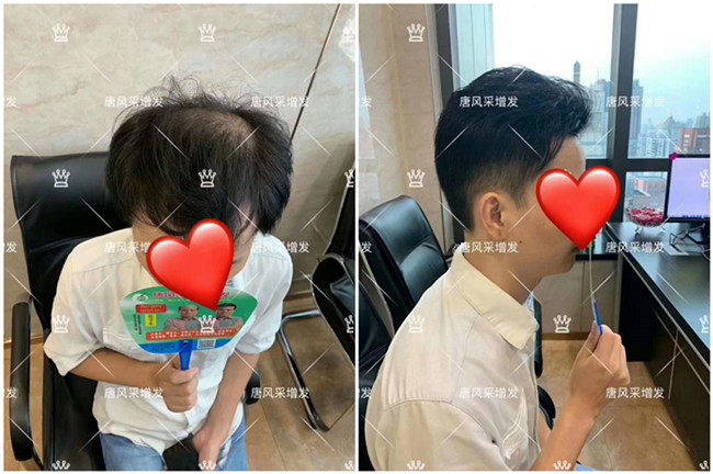男士定做假發(fā) \