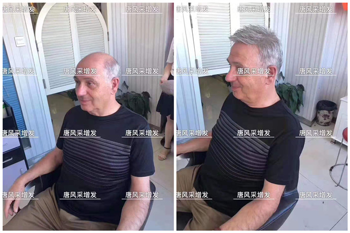 男士定做假發(fā) \