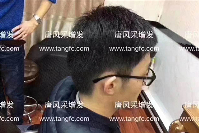 隱形假發(fā)是真的嗎 \