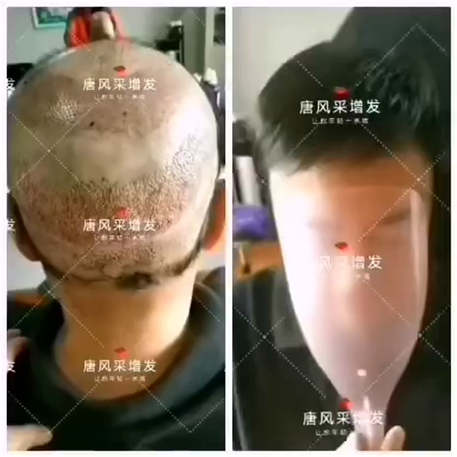 假發(fā)經(jīng)濟 \