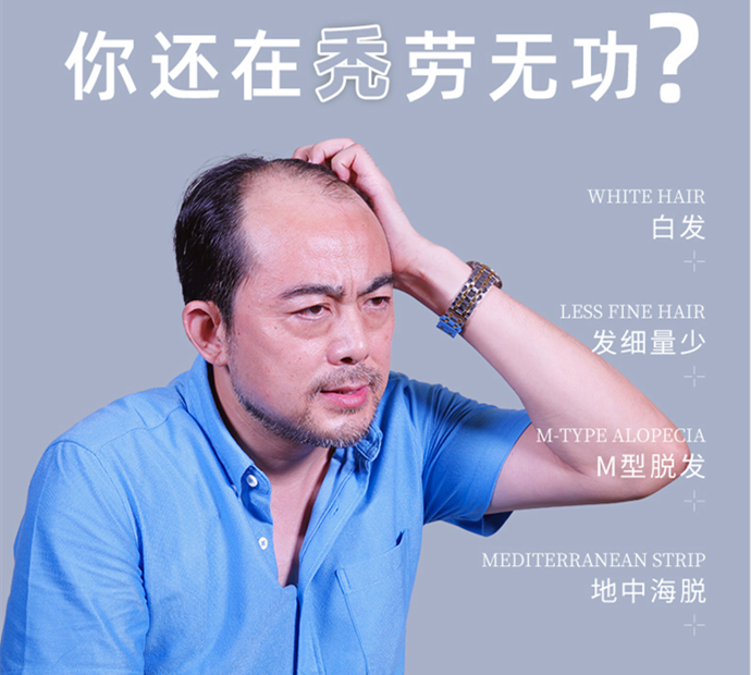 頭頂補(bǔ)發(fā)片好用嗎 \