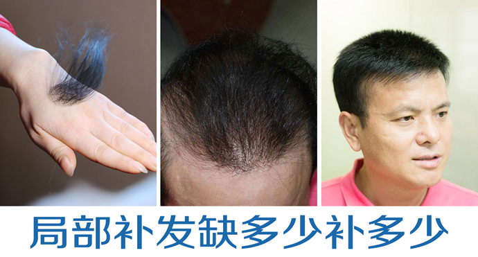 什么牌子的假發(fā)最好 \