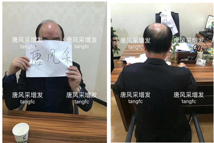 假發(fā)套一般價(jià)格多少錢(qián) \