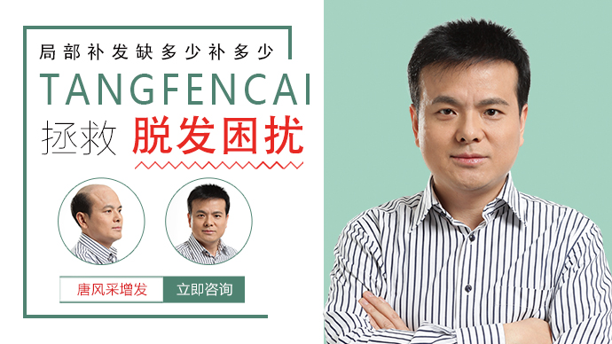 真發(fā)假發(fā)品牌哪家好 \